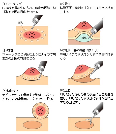 （オリンパス お腹の健康ドットコム より引用）