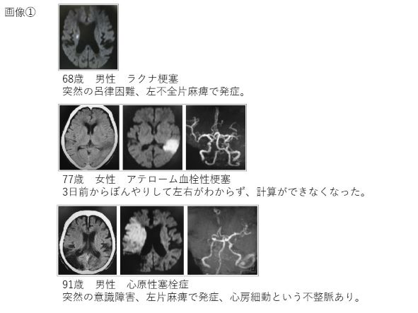 画像①