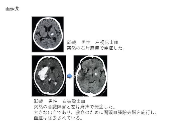 画像⑤